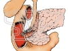 Gallbladder